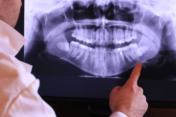 Best Emergency Treatment for Dental Infections or Abscesses in Reedsburg, WI