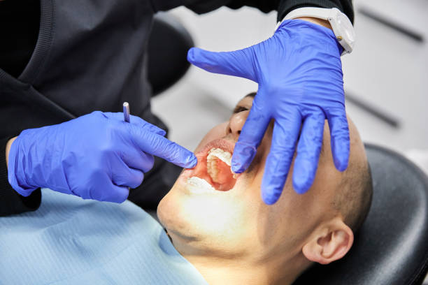 Best Emergency Dental Care for Broken or Chipped Teeth in Reedsburg, WI
