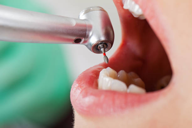 Best Emergency Denture Repair in Reedsburg, WI